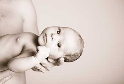 Seborrheic dermatitis (cradle cap)