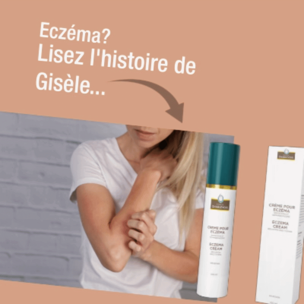 crème pour eczéma